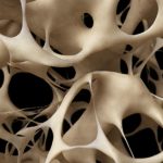 New Study on Hip Fracture Recovery and Osteoporosis Awareness Month